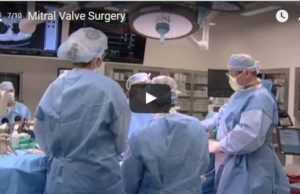 “Our goal is to use the least invasive approach” for mitral valve surgery, surgeons say
