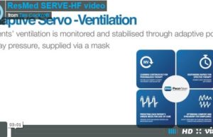 SERVE-HF: largest trial assessing benefits of treating HF patients with sleep-disordered breathing