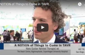 A NOTION of things to come in TAVI