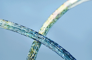 First US patient enrolled in BIOFLOW-V study of Orsiro