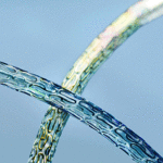 BIOTRONIK_Orsiro-MAIN