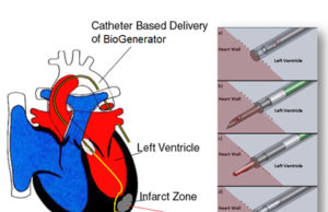NuVascular Technologies and Worcester Polytechnic Institute to commercialise stem cell treatment for heart damage
