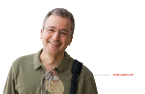 Sunshine Heart provides update on COUNTER HF US study for C-Pulse heart assist system