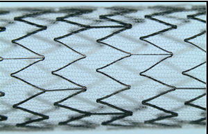 InspireMD CGuard reports positive results at EuroPCR 2015