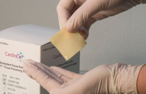 Positive preclinical data for trileaflet repair with CardioCel presented at EACTS