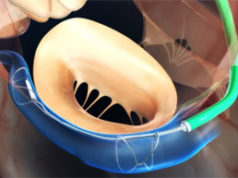 Cardiac Dimensions appoints Matthew Stark as vice president of Clinical and Regulatory Affairs