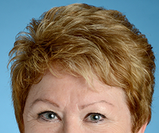 Confounders can partly explain obesity paradox in STEMI patients