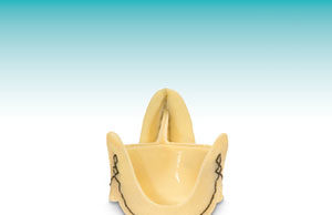 Freedom Solo demonstrates low mortality rate at one year