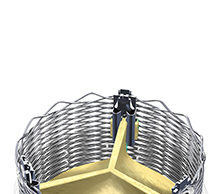 Lotus valve system demonstrates strong performance and safety profile at six months