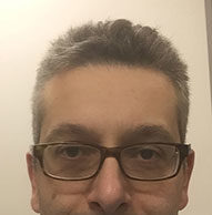 Prognosis is significantly worse with non-access site bleeding