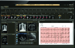 Philips introduces IntelliSpace Cardiovascular at the American College of Cardiology Meeting