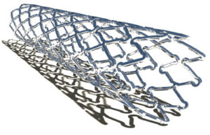 Qvanteq AG enrols first patient in QUEST I clinical study