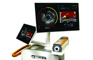 Infraredx to launch TVC Imaging System and TVC Muller Extended Bandwidth NIRS-IVUS Catheter at ACC 2015