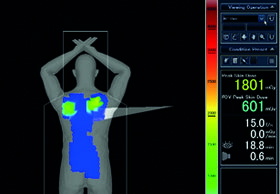 Toshiba Dose Tracking System awarded Novation’s Innovative Technology Designation