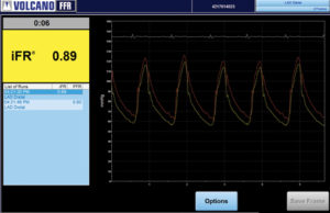 Volcano announces 1,000th system activated with iFR modality worldwide