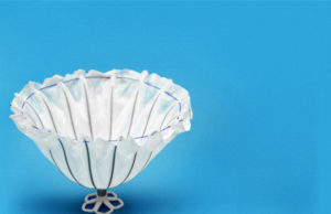 One-year clinical data from European trial shows consistent, compelling positive results for patients treated with minimally invasive device for heart failure