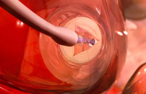 US FDA gives approval to commercialise AI software to guide transcatheter procedures