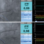 iFr-readings