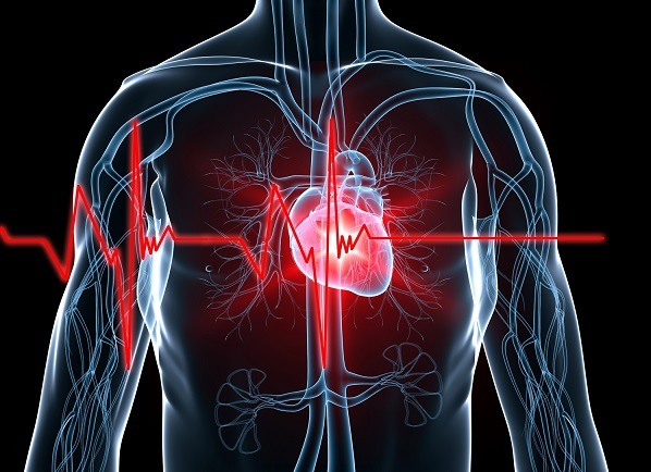 Heartbeat - heart attack