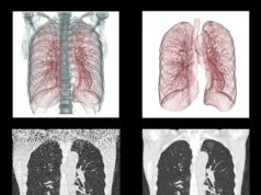 Toshiba receives US FDA clearances for new CT reconstruction tech and Vantage MR software