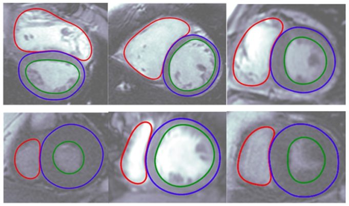 Arterys receives US FDA clearance for cardio imaging analytics software