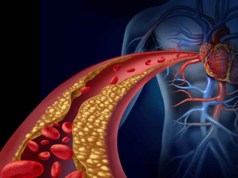 CryoTherapeutics, SpectraWAVE and CRF partner for ICECAP clinical study