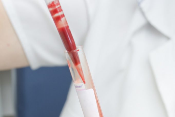 Ultra-sensitive cardiac troponin test using Single Molecule Counting technology receives CE mark