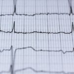 ECG.jpg