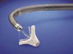 Fourth-generation MitraClip receives FDA approval