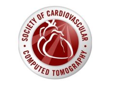 SCCT releases new guideline for use of computed tomography in TAVR procedure