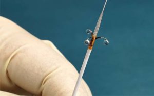 Peregrine catheter: 100% procedural success in post-market clinical trial