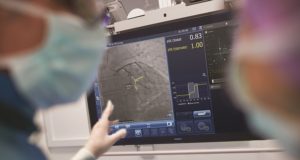 Philips iFR Coregistration SyncVision