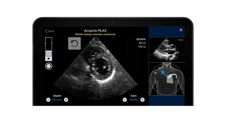 AI-guided cardiac imaging system given FDA authorisation