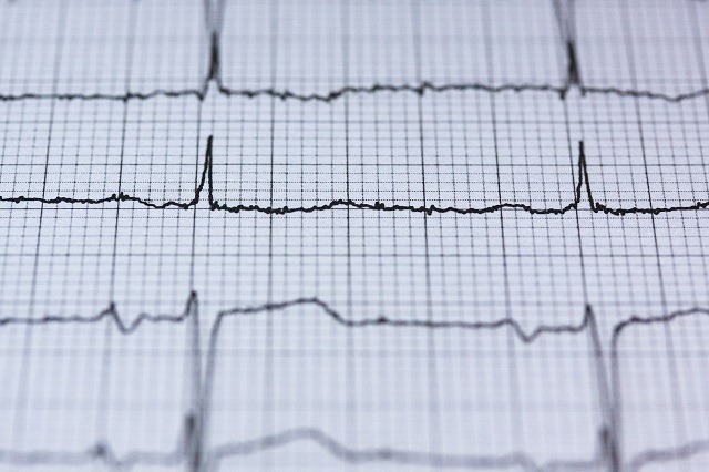 FDA issues new policy on remote monitoring devices for use during COVID-19 pandemic