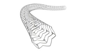 Advertorial: Stent overexpansion is key to overcoming variable diameter in complex PCI cases