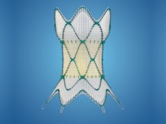 Harmony transcatheter pulmonary valve gains CE mark