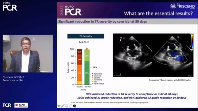 TRISCEND study demonstrates significant reduction in TR with Evoque tricuspid valve