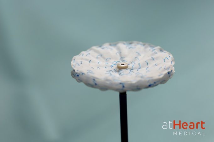 First patients treated with reSept ASD occluder in IDE trial