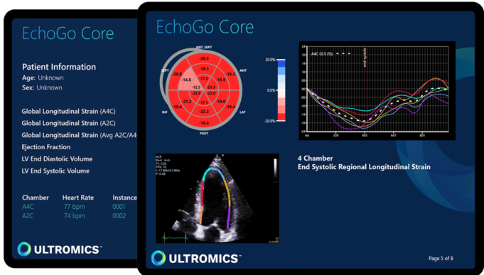 Ultromics completes US$33 million Series B funding round