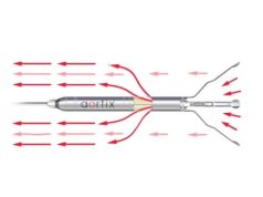 Aortix