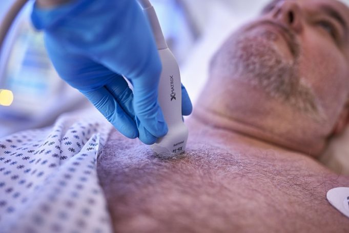 Philips expands cardiac ultrasound portfolio