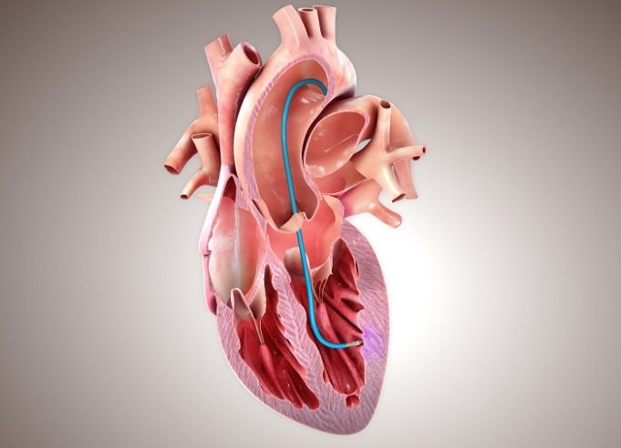 Breakthrough designation granted to CardiaAMP cell therapy system for heart failure treatment