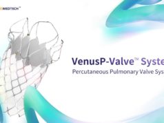 VenusP-Valve gains CE mark VenusP-Valve