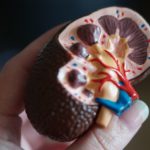 kidney scale model