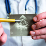 Doctor holds snapshot of ultrasound of heart and indicates with