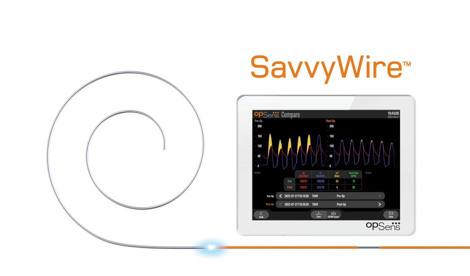 First US TAVI procedure performed using SavvyWire guidewire