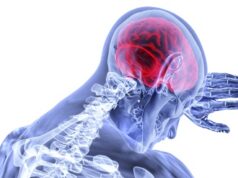 CAPTURE-1 study of EmStop embolic protection system concludes