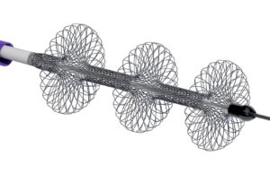 Inari Medical announces first patient enrolment in PEERLESS II randomised controlled trial