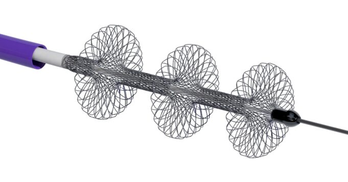 Inari Medical announces first patient enrolment in PEERLESS II randomised controlled trial