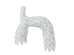 Endospan releases early TRIOMPHE IDE study results at STS 2024 TRIOMPHE